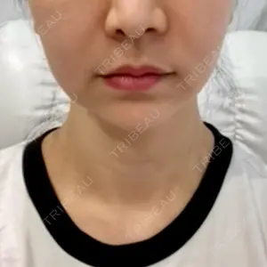口コミ