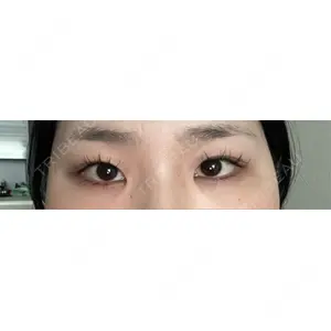LUHO（ルホ）美容外科口コミ