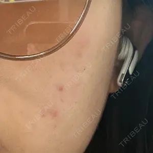 ハナビューティークリニック口コミ