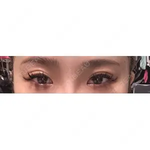 口コミ