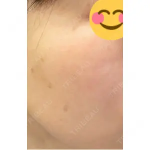AZ BEAUTY CLINIC口コミ