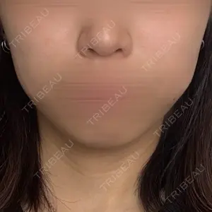 口コミ