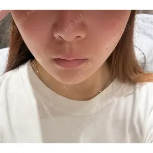 HAAB×DREAM BEAUTY CLINIC HAAB×DREAM BEAUTY CLINIC 大阪梅田院口コミ