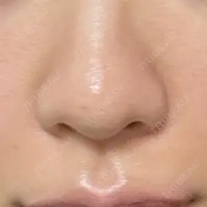 口コミ