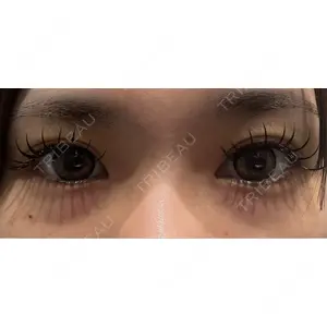 Nebula Clinic ネビュラクリニック 広島院口コミ