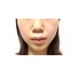 CZEN CLINIC 銀座院口コミ