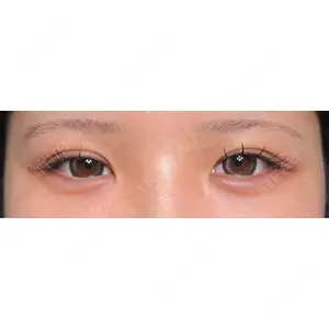 HAAB×DREAM BEAUTY CLINIC HAAB×DREAM BEAUTY CLINIC 大阪梅田院口コミ