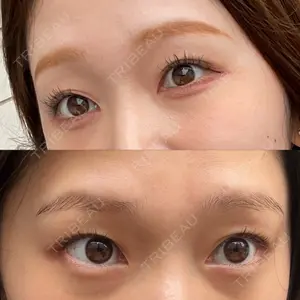 LUHO（ルホ）美容外科口コミ