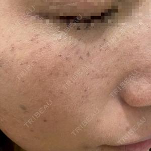 ルラ美容クリニック ルラ美容クリニック 広島院口コミ
