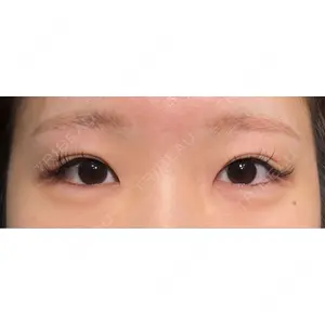 HAAB×DREAM BEAUTY CLINIC HAAB×DREAM BEAUTY CLINIC 大阪梅田院口コミ