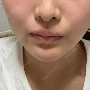 HAAB×DREAM BEAUTY CLINIC HAAB×DREAM BEAUTY CLINIC 東京本院口コミ