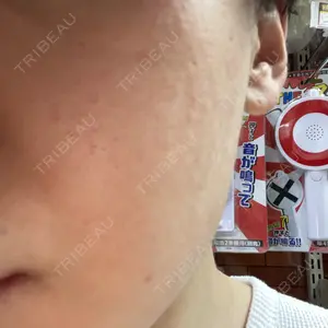ルラ美容クリニック ルラ美容クリニック 高田馬場院口コミ