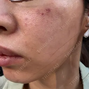 ソウルアイ美容外科医院口コミ