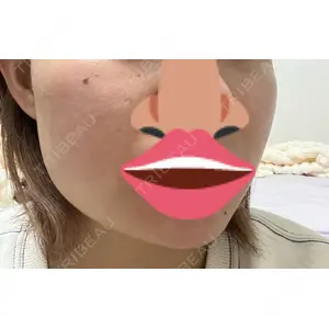 口コミ