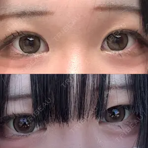 オーキッド美容クリニック東京御徒町口コミ
