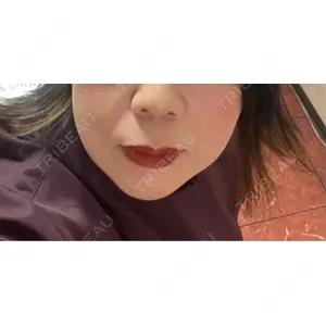 TCB東京中央美容外科 TCB東京中央美容外科 京都四条院口コミ