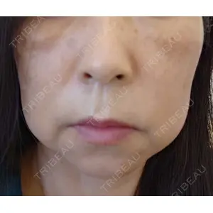 A CLINIC（エークリニック） A CLINIC（エークリニック） 横浜院口コミ