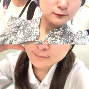 TCB東京中央美容外科 TCB東京中央美容外科 名古屋栄院口コミ