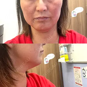 湘南美容クリニック 湘南美容クリニック 藤沢院口コミ