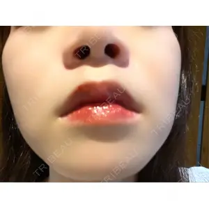 口コミ