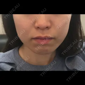 TCB東京中央美容外科 TCB東京中央美容外科 新宿東口院口コミ