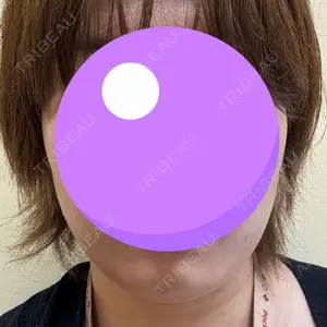 DMTC美容皮膚科 DMTC美容皮膚科 渋谷院口コミ