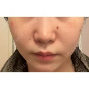 おおかみ美容のクリニック おおかみ美容のクリニック 新宿院口コミ