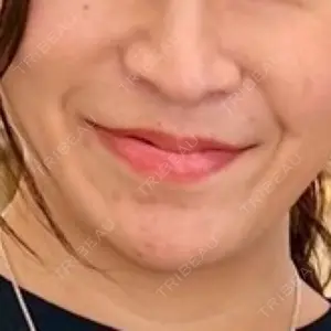 東京シンデレラ美容外科 東京シンデレラ美容外科 池袋院口コミ