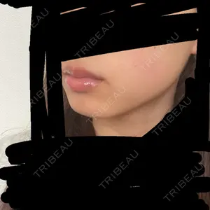 TCB東京中央美容外科 TCB東京中央美容外科 天王寺院口コミ