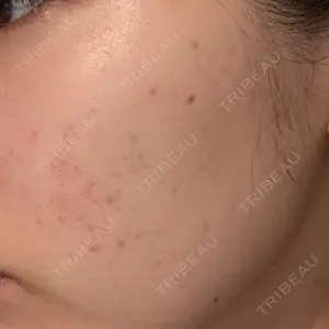 L‘amour clinic Tokyo【ラムールクリニック東京】口コミ