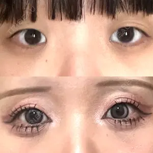 口コミ