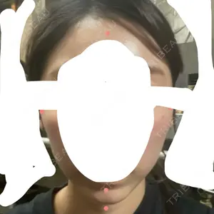 PureMe Skin Clinic（ピュアミースキンクリニック麻布）口コミ