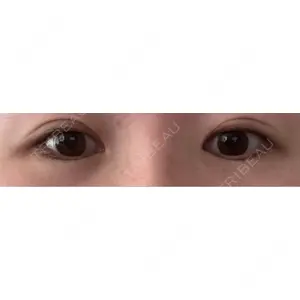 サラ美容外科口コミ