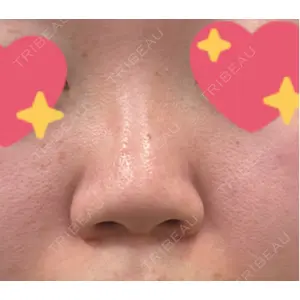サラ美容外科口コミ