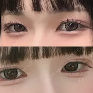 口コミ