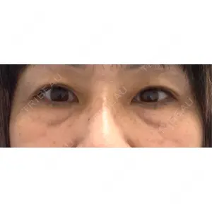 口コミ
