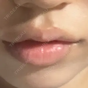 口コミ