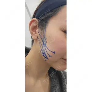 アリエル美容クリニック アリエル美容クリニック 大宮院口コミ