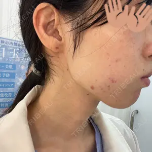 ルラ美容クリニック ルラ美容クリニック 上野院口コミ