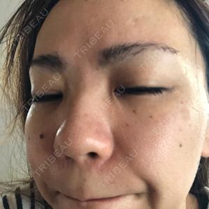 TCB東京中央美容外科 TCB東京中央美容外科 那覇院口コミ