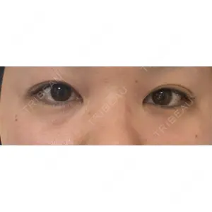 LUHO（ルホ）美容外科口コミ