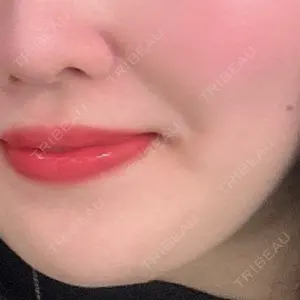 プライベートスキンクリニック 梅田本院口コミ