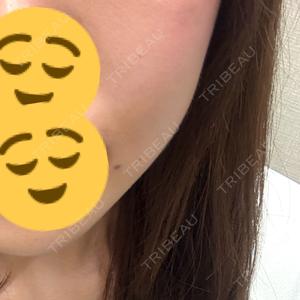 東京美容外科 東京美容外科 池袋院口コミ