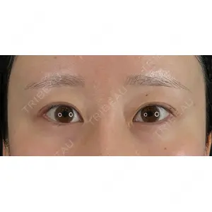 藤・ナチュレ美容クリニック 藤・ナチュレ美容クリニック 銀座院口コミ