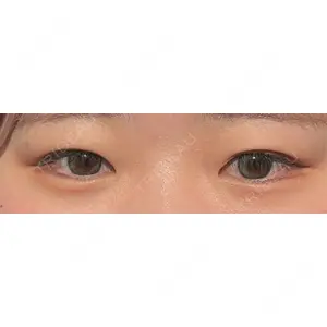ルラ美容クリニック ルラ美容クリニック 札幌院口コミ