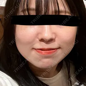 ルラ美容クリニック ルラ美容クリニック 池袋院口コミ