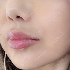 NARU Beauty Clinic NARU Beauty Clinic 【ナルクリ】口コミ