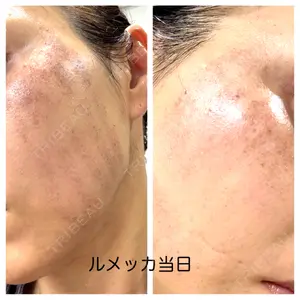 ルラ美容クリニック ルラ美容クリニック 広島院口コミ