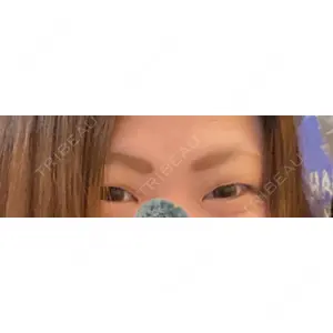 LUHO（ルホ）美容外科口コミ