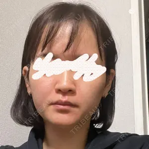 PRO CLINIC プロクリニック 銀座院口コミ